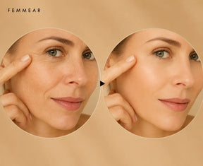 Ice Globo - Massageador Facial de Esferas de Gelo