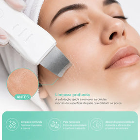 Aparelho Peeling Ultrassônico