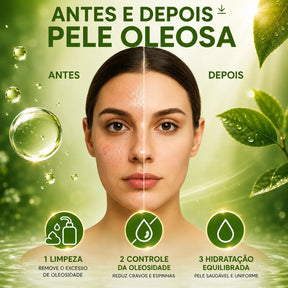 KIT ANTIOLEOSIDADE E ÁCIDO SALICÍLICO FEMMEAR
