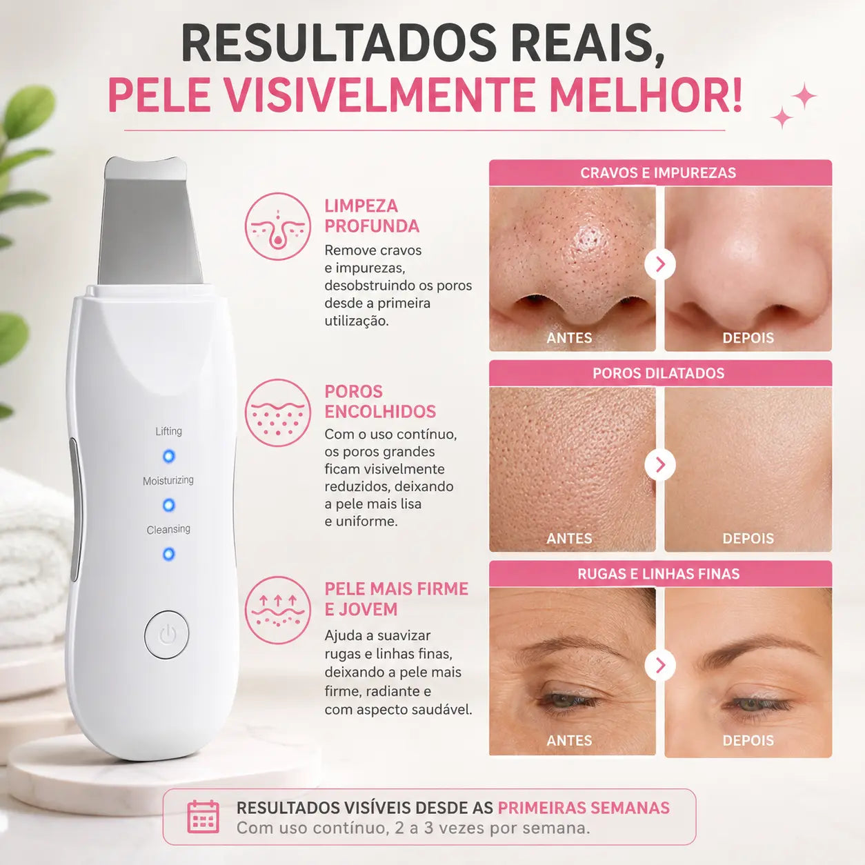 Aparelho Peeling Ultrassônico