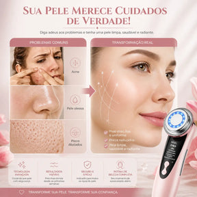 EM OFERTA DISPONIVEL - Massageador Eletrico FACIAL 4 em 1