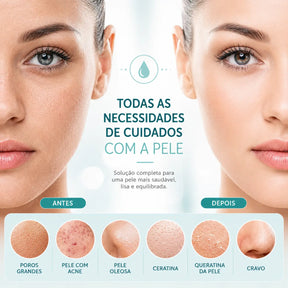 Escova Facial Elétrica de Limpeza Profunda