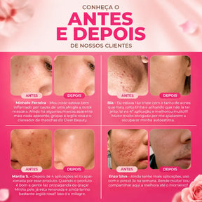 Máscara Facial 3 em 1 Com Ácido Hialurônico - 90g